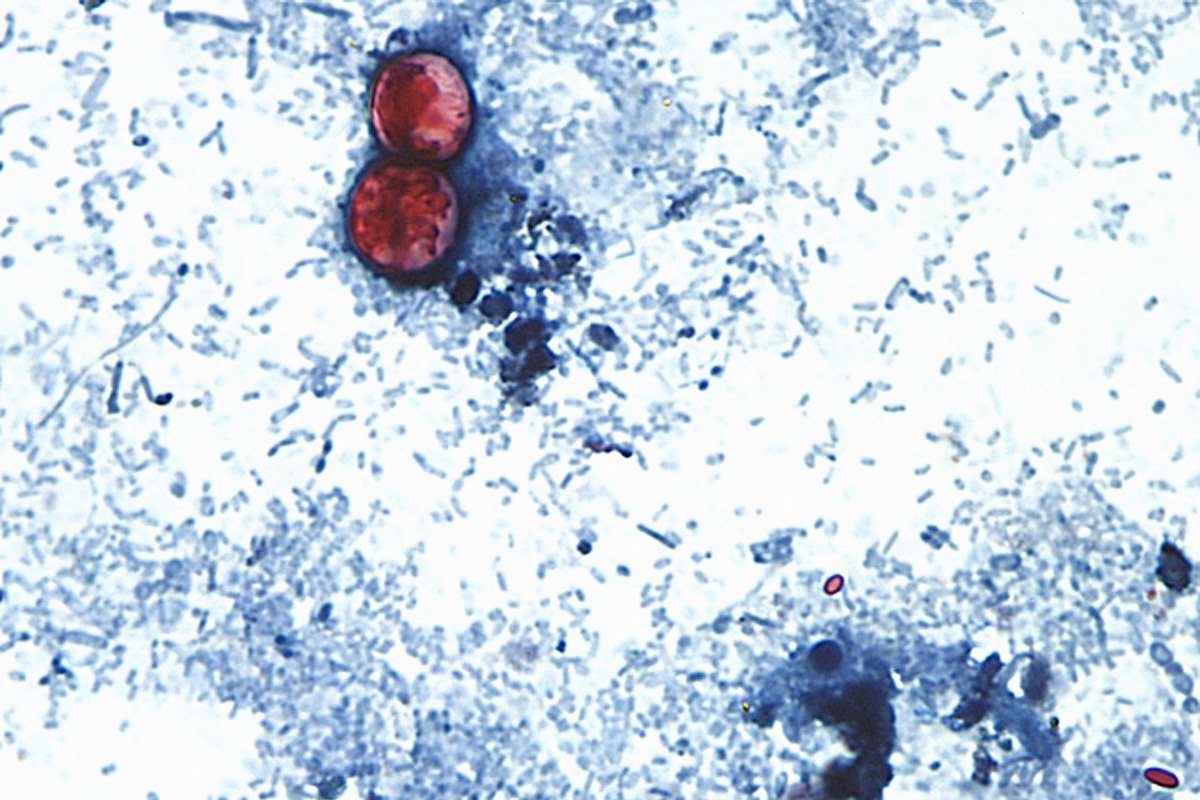 Esta fotografía tomada a través de un microscopio y difundida por los CDC muestra Cyclospora cayetanensis oocysts de una muestra de heces. | AP