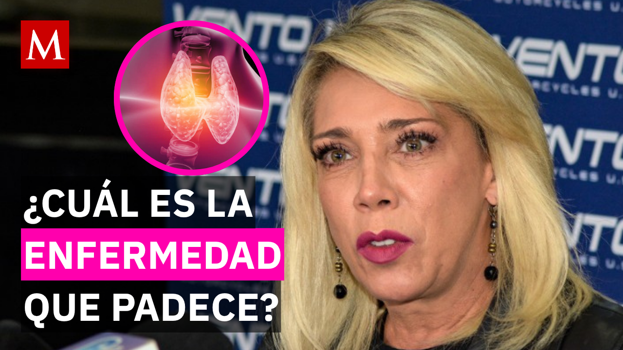 "No se quita nunca": Cynthia Klitbo revela detalles de la enfermedad de Hashimoto en LCDLF