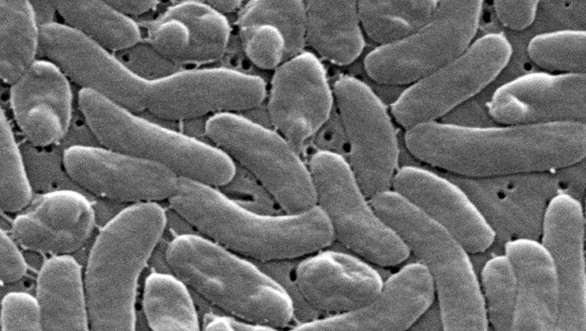 Bacterias Vibrio vulnificus. | AP