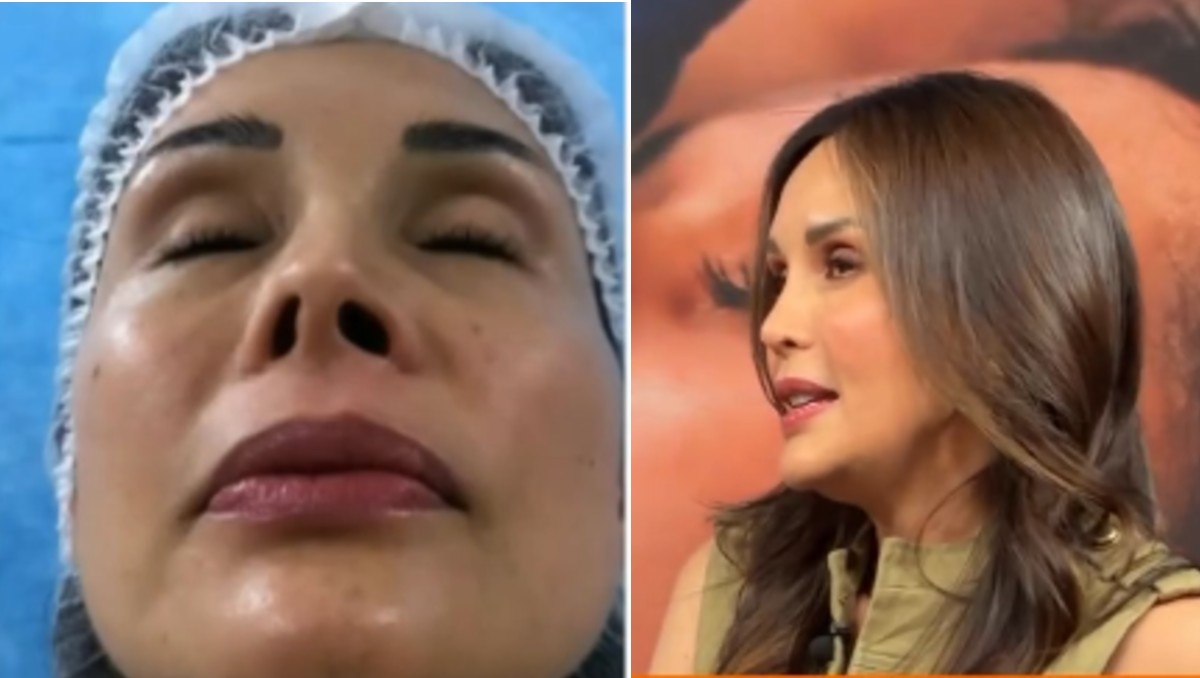 Tanya Vázquez habló de las secuelas en su nariz. | FOTO: Captura Sale el Sol