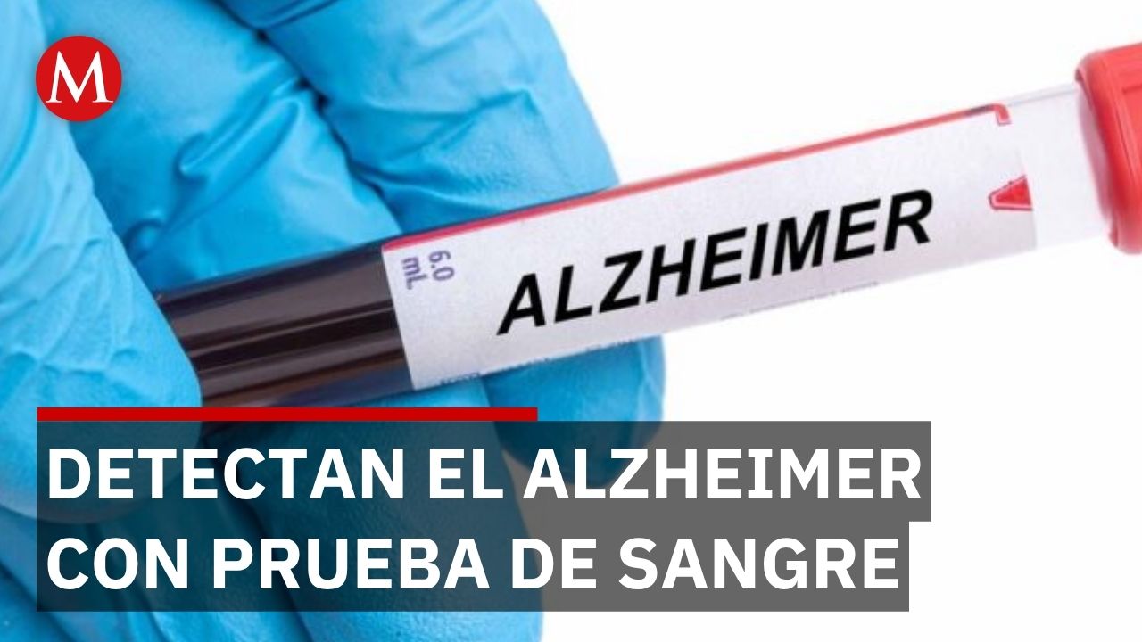 FDA aprobó pruebas de sangre para detectar Alzheimer en 2025 pero con limitaciones