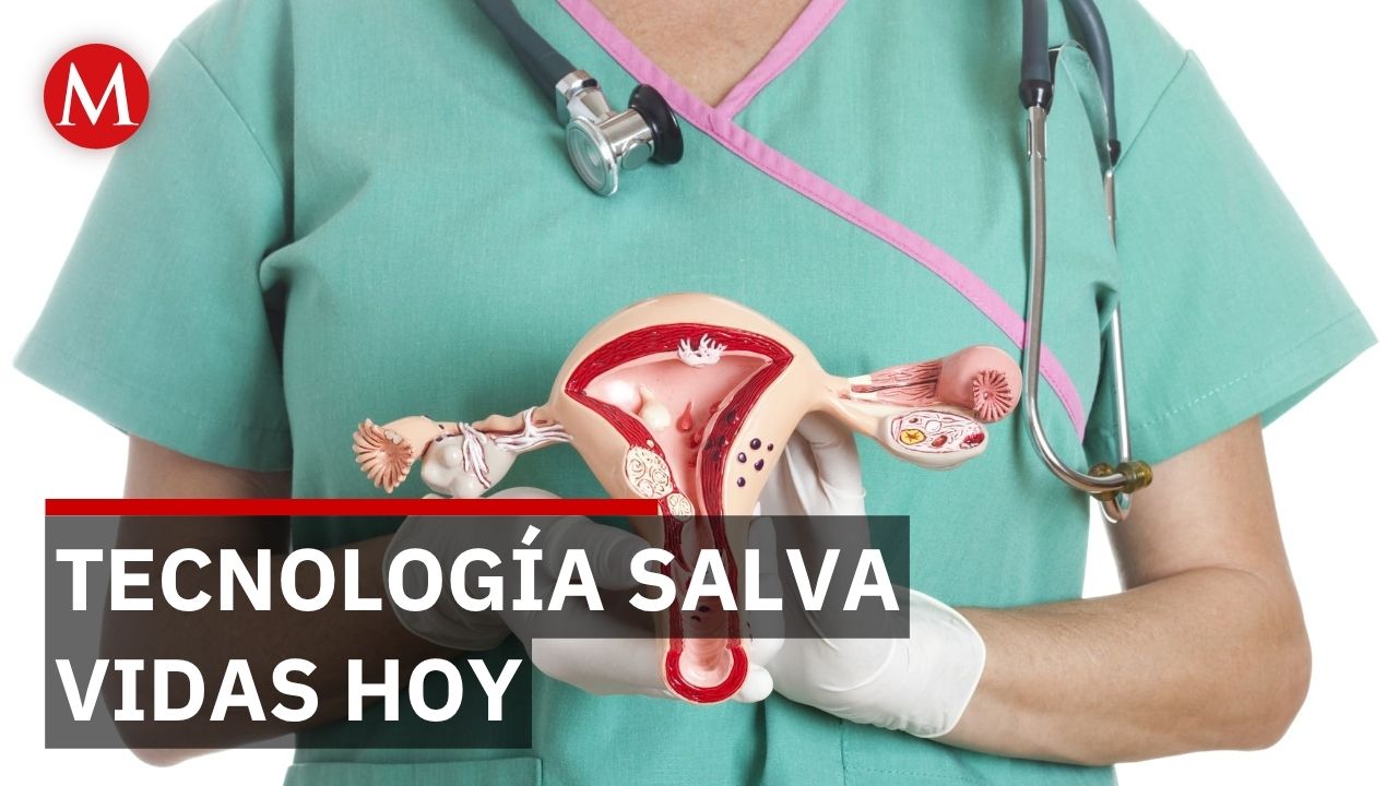 Investigadores del IPN crean herramienta de IA para detectar cáncer cervicouterino