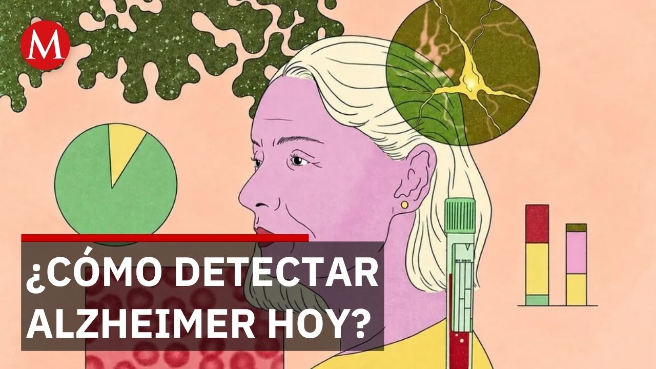Nuevas pruebas de sangre detectan Alzheimer pero expertos advierten no usarlas aún