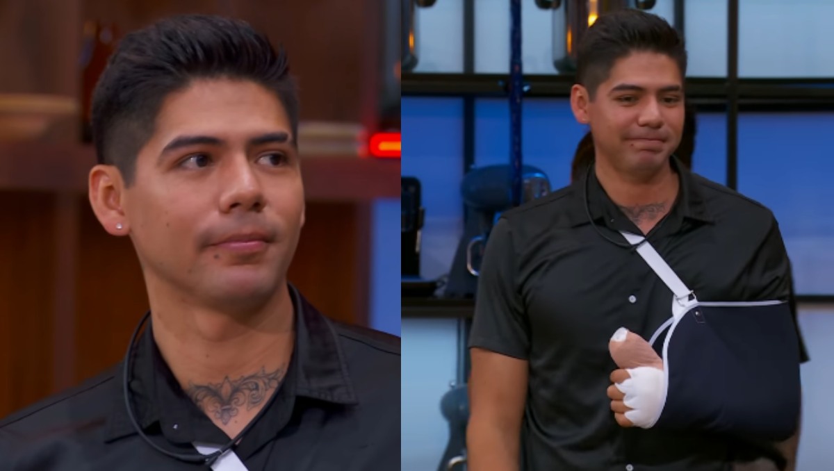 Antrax preocupa por posible NECROSIS tras accidente en MasterChef 24/7 | Redes sociales