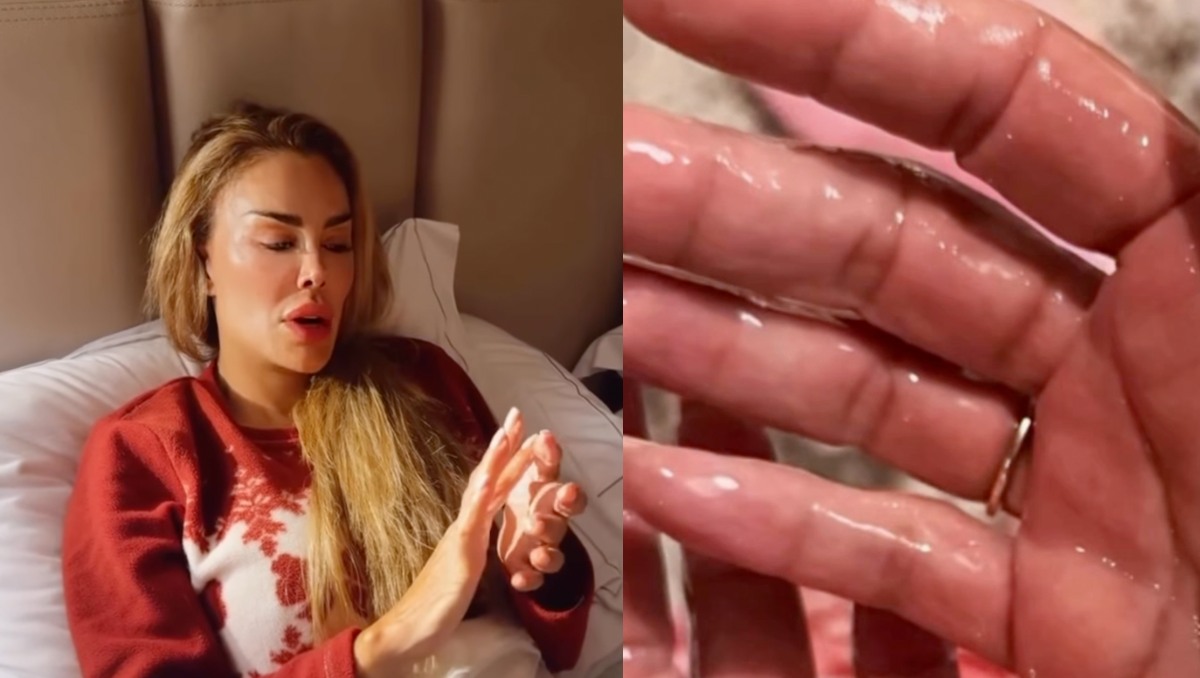¿Qué le pasó a Ninel Conde en ‘Top Chef VIP’? La cantante PREOCUPA a sus seguidores tras sufrir QUEMADURAS | Redes sociales