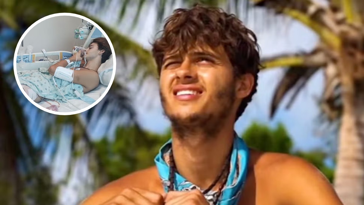 Participante de 'Survivor' pierde una pierna | Especial