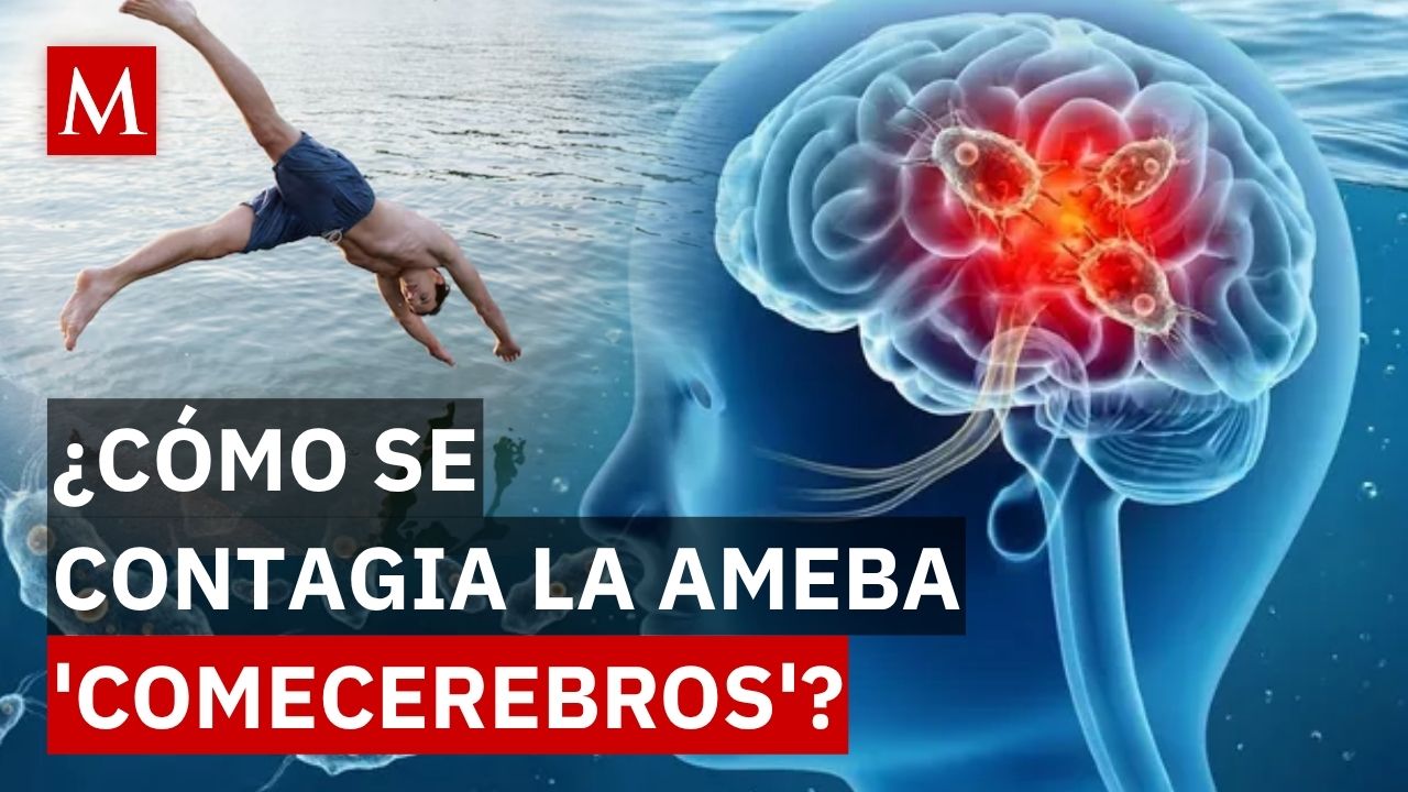 Ameba comecerebros en Yucatán: ¿qué hacer ante los primeros síntomas de contagio?