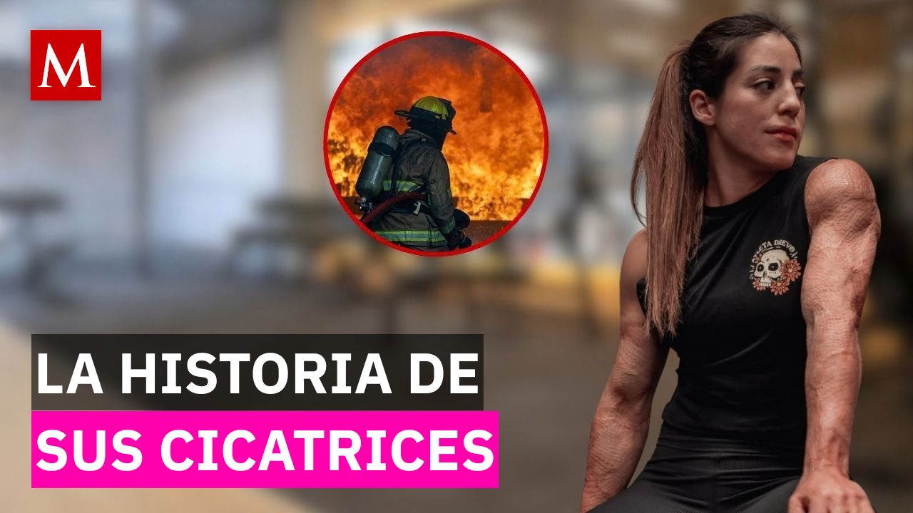 Mariana Khalil, finalista de 'Habilidad Física 100', revela la explosión que sobrevivió de niña