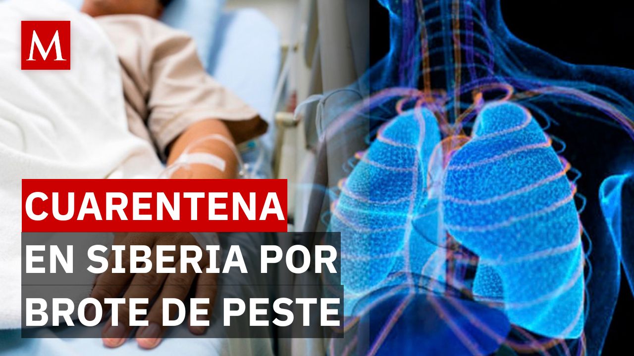 ¡Hospitales en cuarentena en Siberia! Murió una científica y temen brote de peste pulmonar