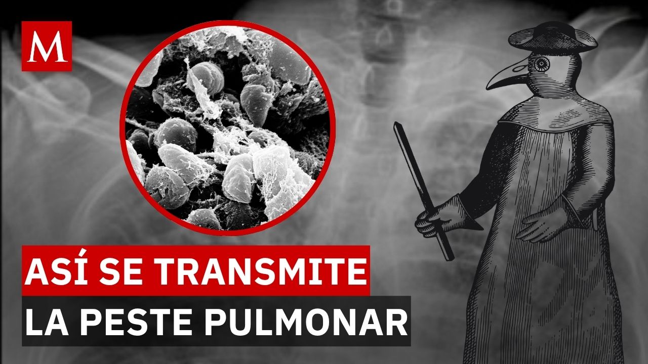 ¿Fuga biológica o neumonía? El misterio tras la muerte de una laboratorista en Irkutsk