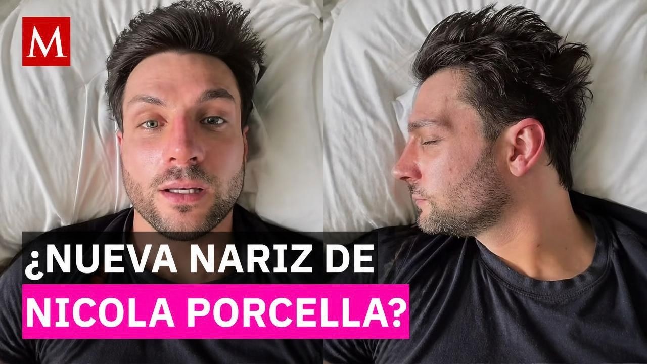 Nicola Porcella sorprende con cambio en su nariz y recibe críticas