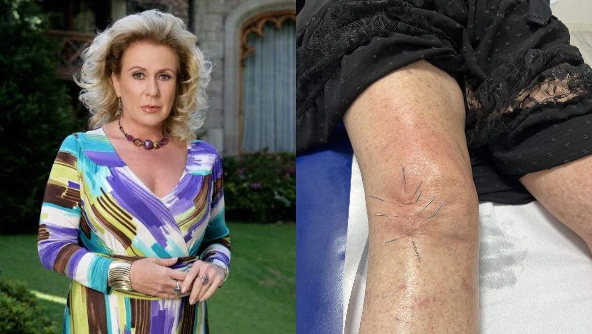 ¿Qué le pasó a Laura Zapata en la rodilla? La actriz comparte FOTOS de su recuperación; confiesa que es muy doloroso | Redes sociales