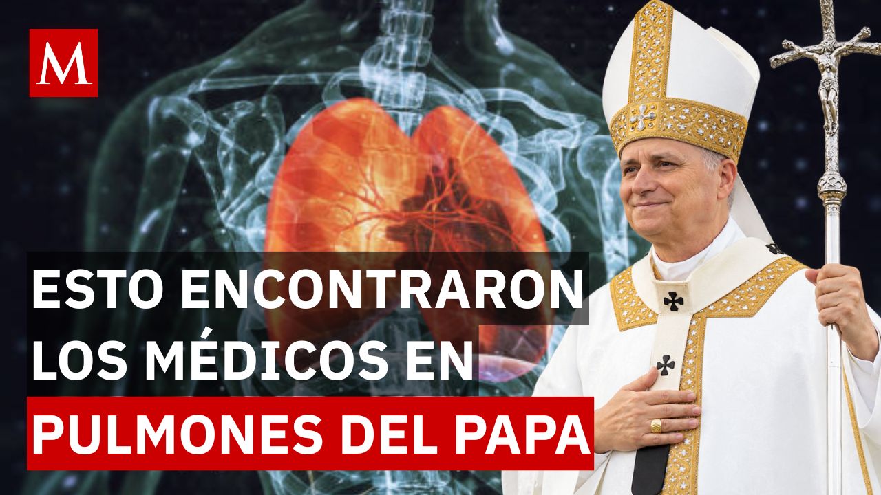¡Alerta en el Vaticano! El papa León XIV anuncia intervención médica por hallazgo en el pulmón