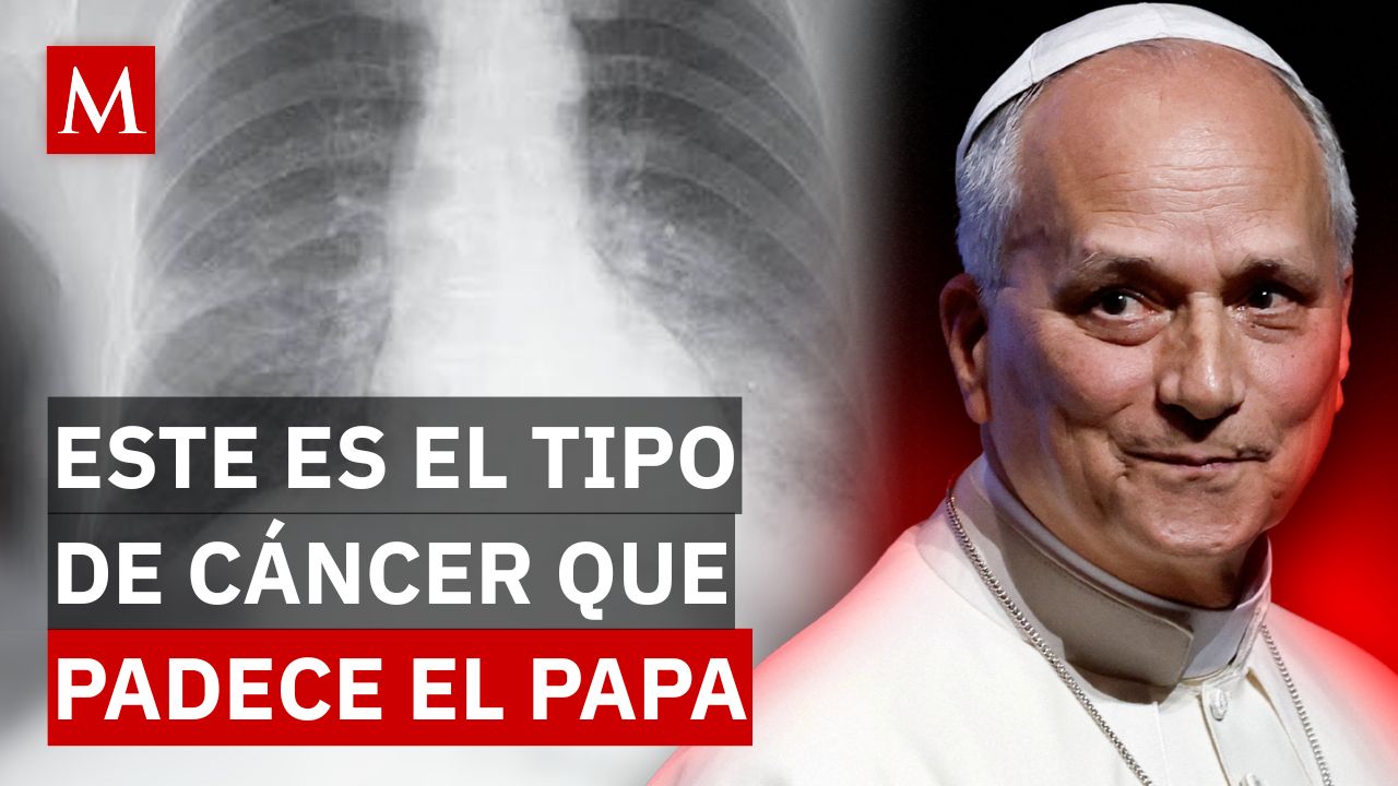 ¿Qué síntomas tenía el papa León XIV? Esto se sabe de su cáncer y tratamiento médico