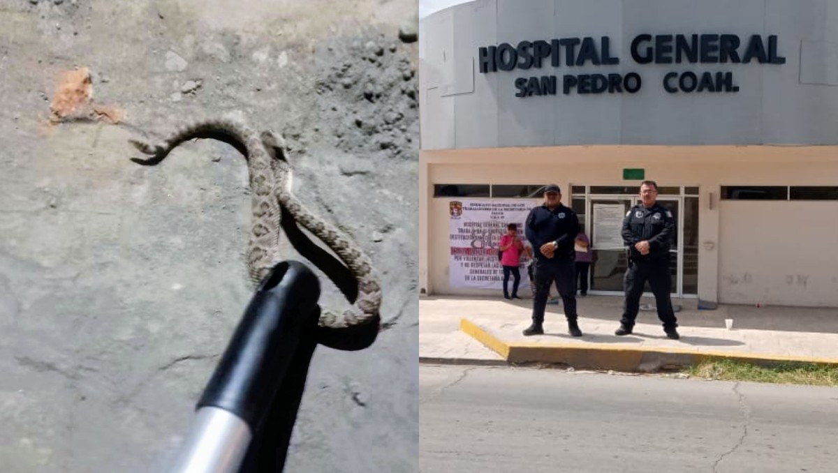 Niña de 3 años es mordida por serpiente de cascabel, la rápida atención médica le salvó la vida. (Damián Ramírez)