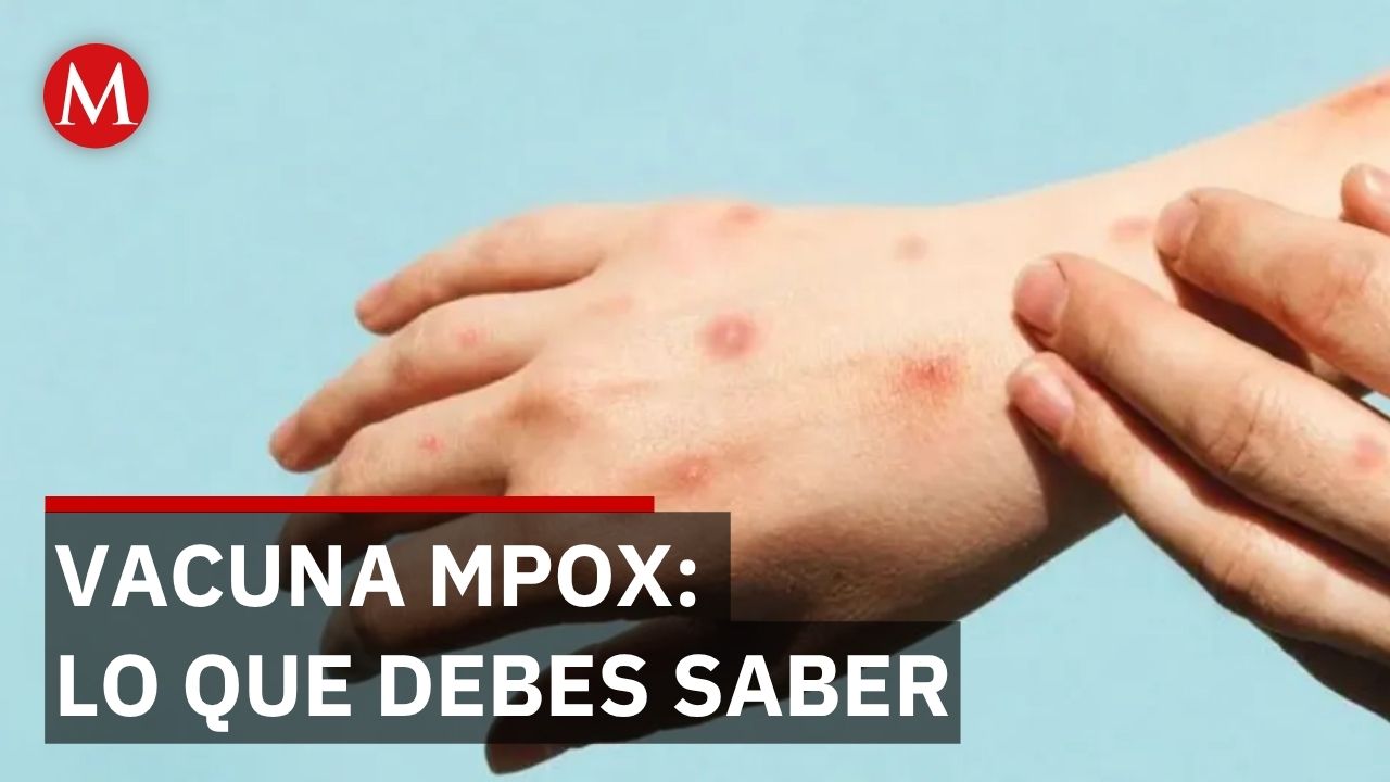 México aplica vacuna focalizada contra MPOX en mayores de edad