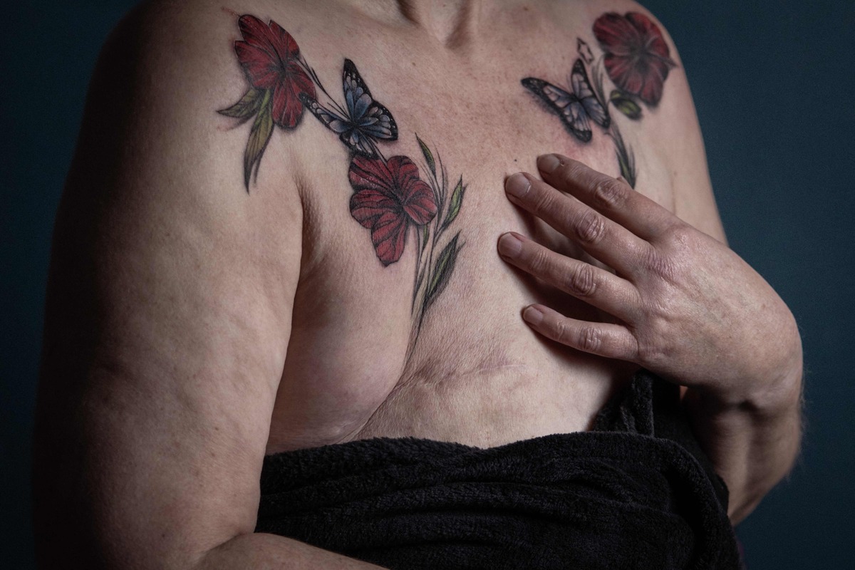 Marissa "Bad Mermaid Ink" realiza una evaluación médica previa antes de colocar los diseños en la piel de las pacientes. | Foto: AFP
