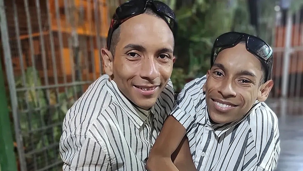 Mueren José Armando y José Luis Cevallos, famosos siameses que soñaban triunfar en la música (IG)