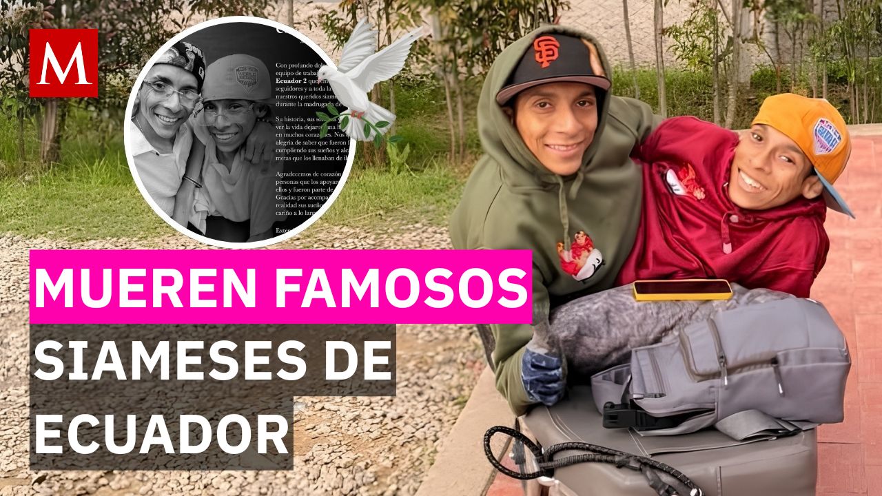 ¿Qué ocurrió con los siameses Cevallos? Conoce los detalles de su triste fallecimiento