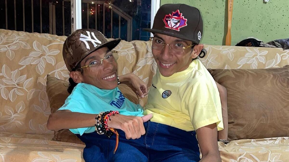 Murieron los Siameses del Ecuador | Instagram