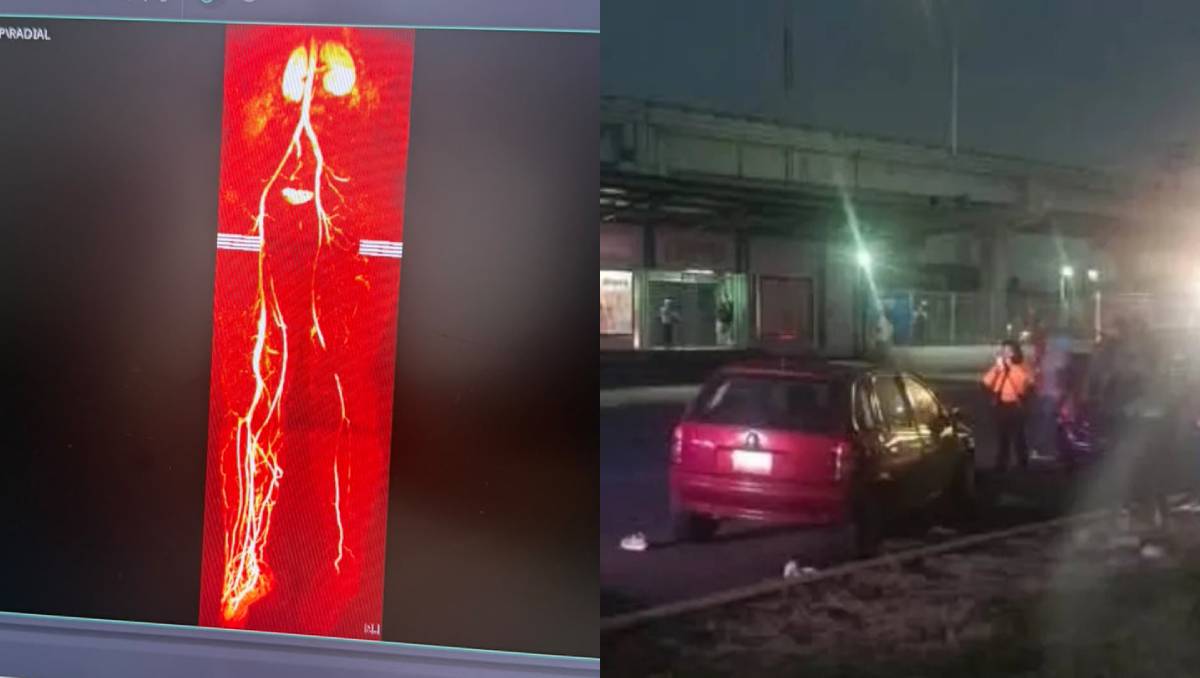Diego y su madre fueron arrollados mientras cambiaban la llanta de un auto en Avenida Central. | Foto: Especial