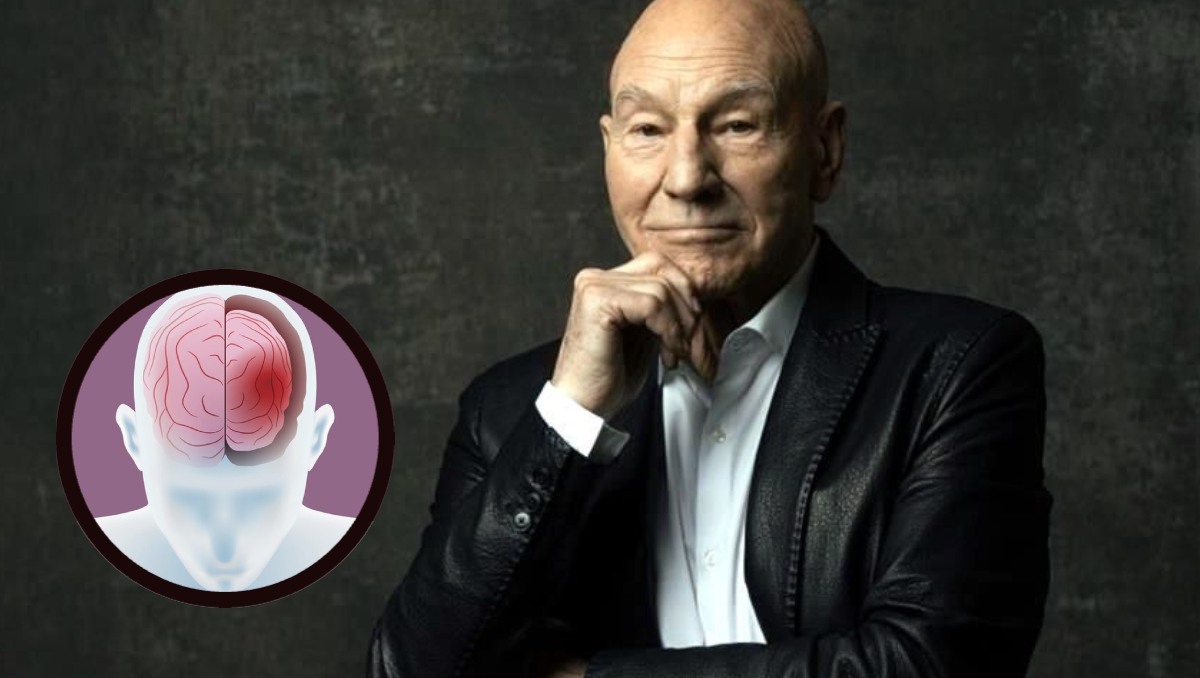 ¿Qué es la demencia con cuerpos de Lewy, la ENFERMEDAD que padecía Patrick Stewart antes de morir? | Especial